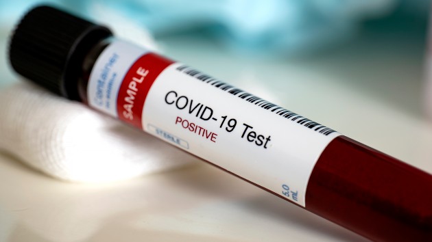covid test